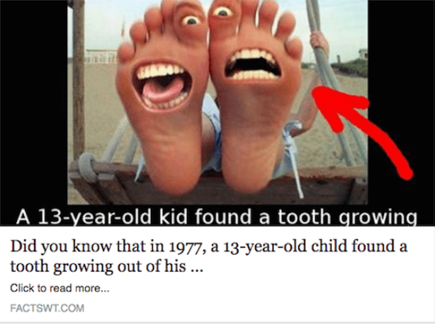 Screenshot-2018-1-12 How Clickbaiting Works